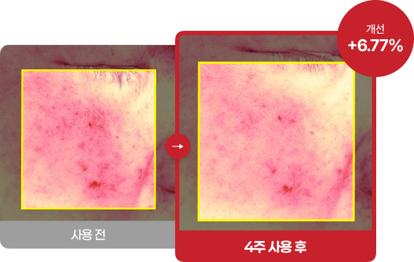 후기 사진